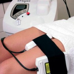 *16 i-lipo treatments with Whole Body Vibration