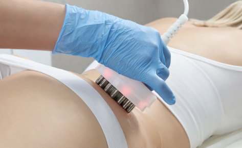 Bodywave Cavitation